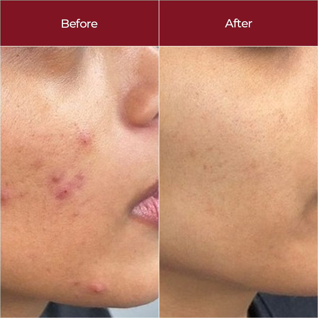 Bright & Glow Serum
