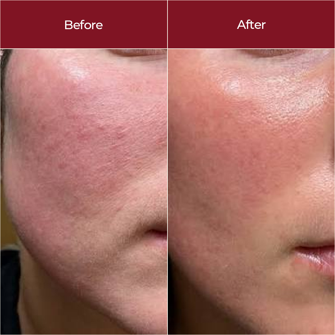 Hydrating Serum