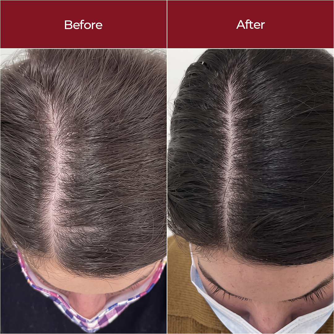 Hair Promo Serum