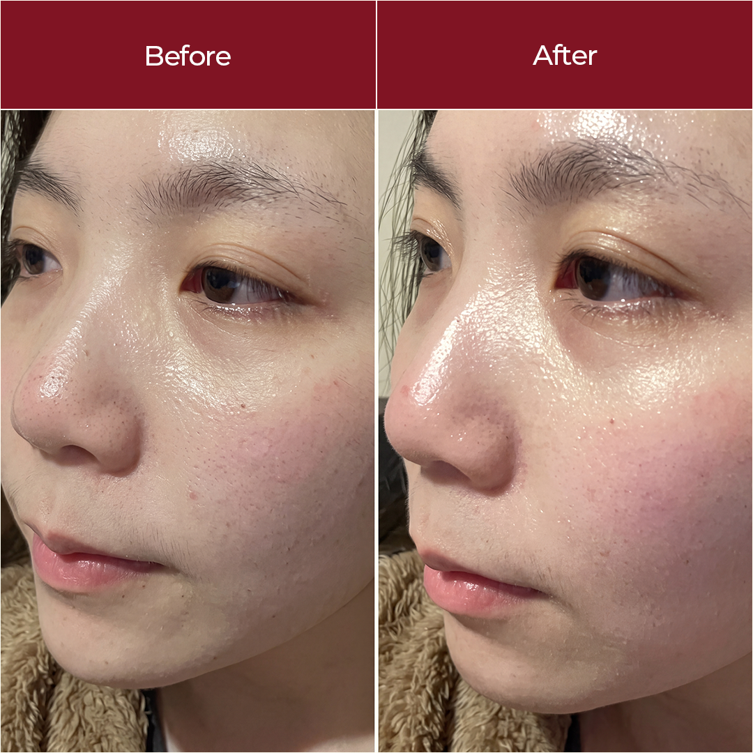 Korean Toner