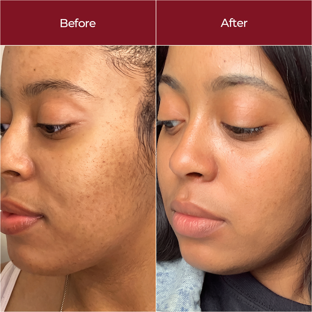 Glycolic Acid 12% Solution