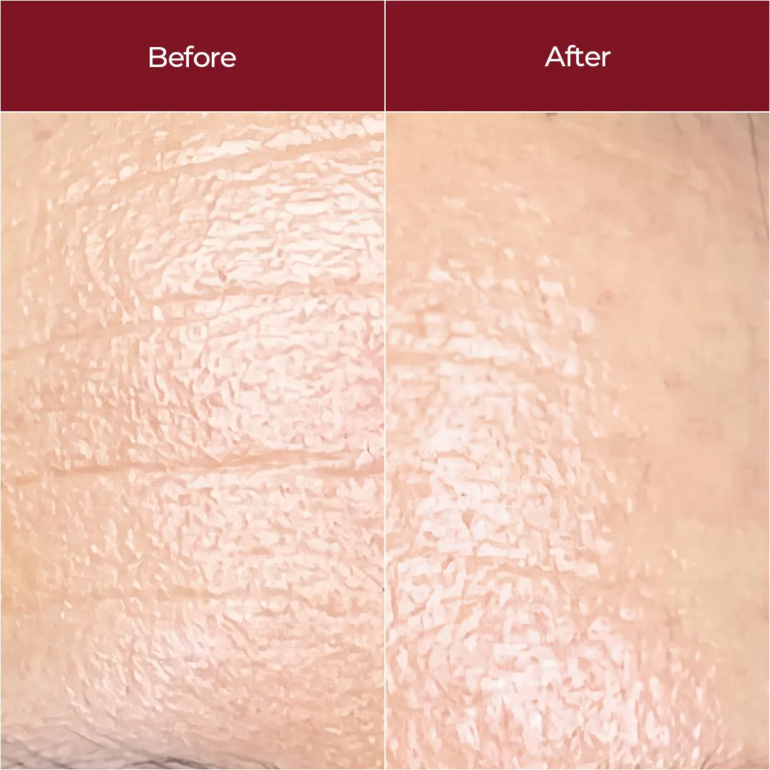 Retinol Super Serum