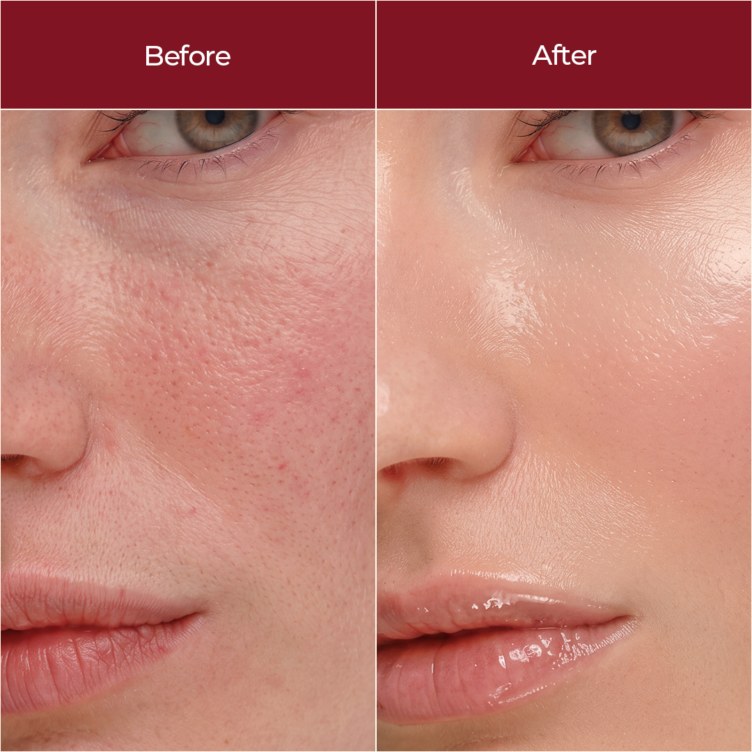 Korean Glass Skin Serum