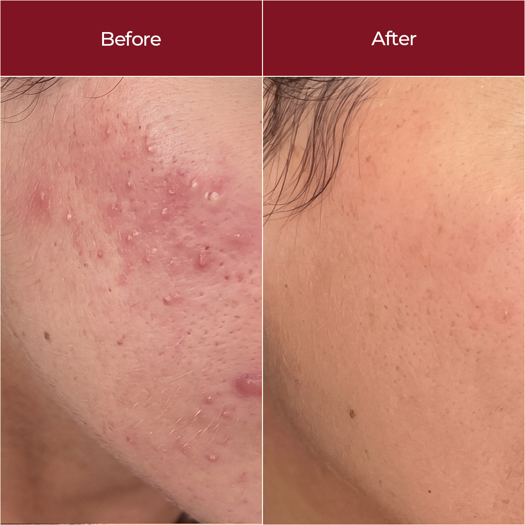 Detox TT Gel Cream