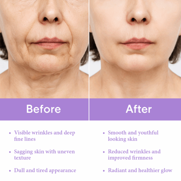 Retinol Super Serum - Image 4